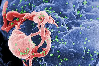 1983 first publications of the discovery of the hiv virus that ca 05 20